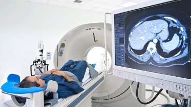 CT scan of brain tumor