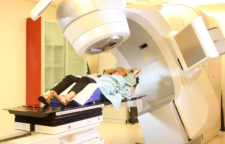 radiation therapy for brain cancer consequences